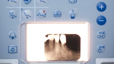 galeria rentgen dentystyczny